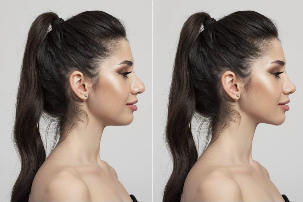 Chin Aesthetics